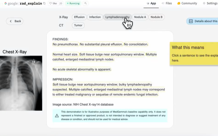 Google Launches Three Specialized Gemma AI Models for Healthcare, Sign Language, and Dolphin Research